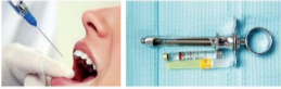 胰島素，牙科麻醉6.png